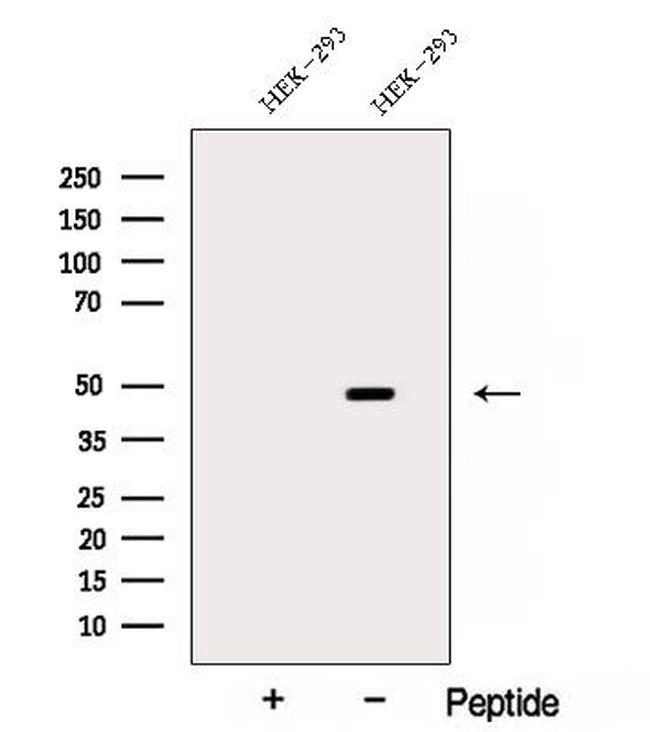 ARP2 Antibody in Western Blot (WB)