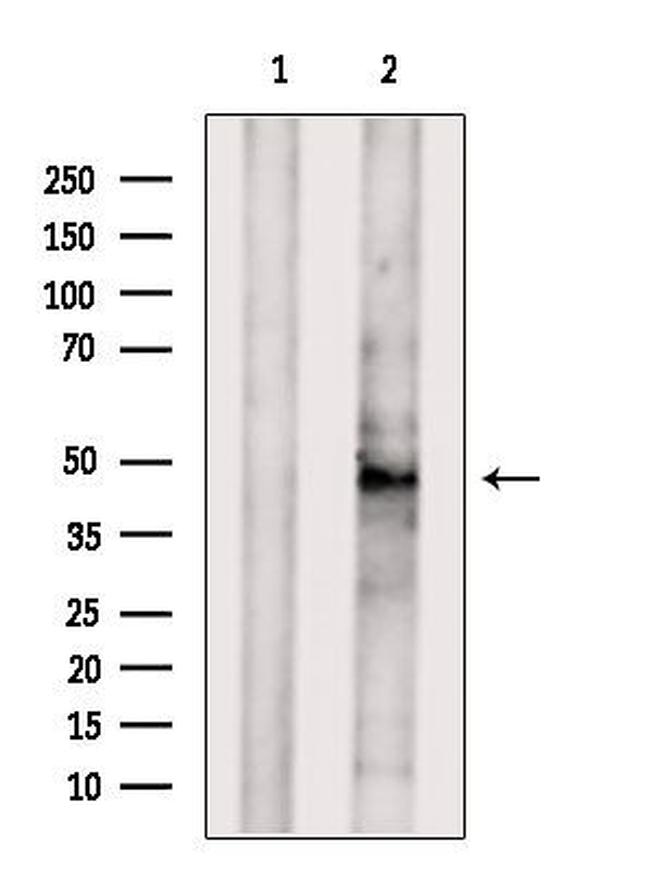 ARP2 Antibody in Western Blot (WB)