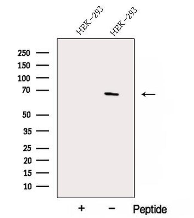 ACTR5 Antibody in Western Blot (WB)