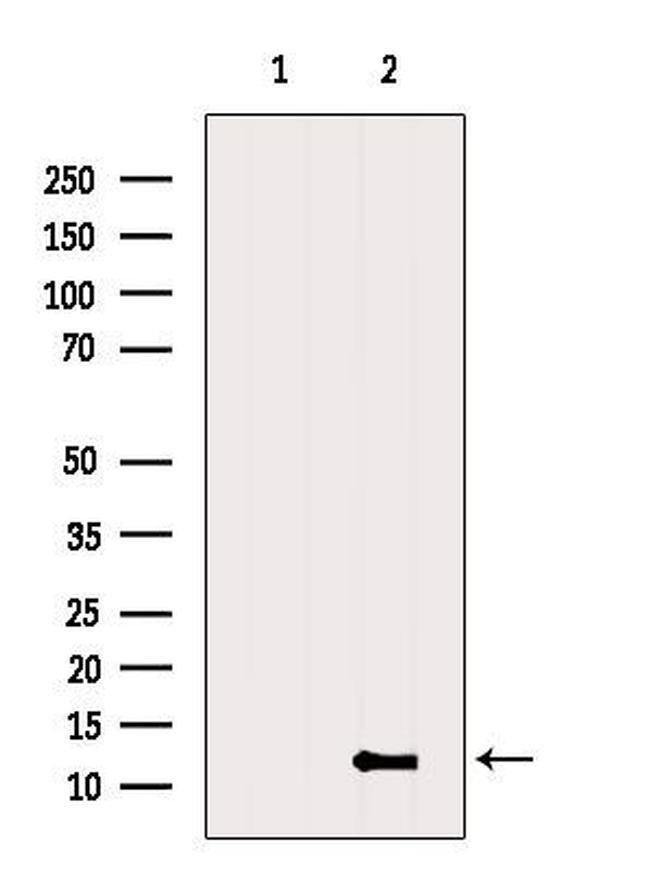 ATPIF1 Antibody in Western Blot (WB)