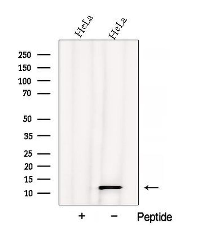 ATPIF1 Antibody in Western Blot (WB)