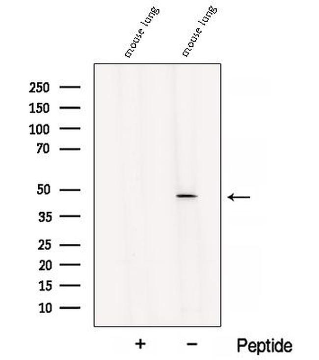 B3GNT3 Antibody in Western Blot (WB)