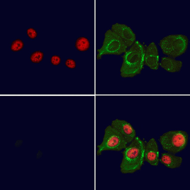 BANP Antibody in Immunocytochemistry (ICC/IF)