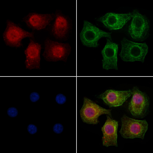 BRD2 Antibody in Immunocytochemistry (ICC/IF)