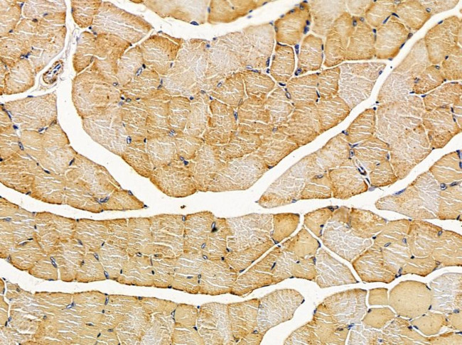 C13orf18 Antibody in Immunohistochemistry (Paraffin) (IHC (P))