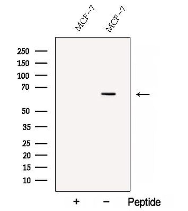 C13orf18 Antibody in Western Blot (WB)