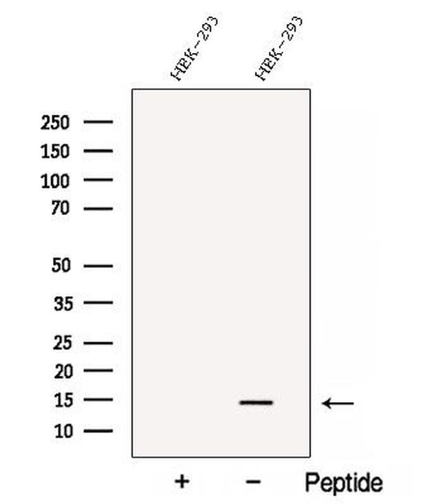 C1orf31 Antibody in Western Blot (WB)