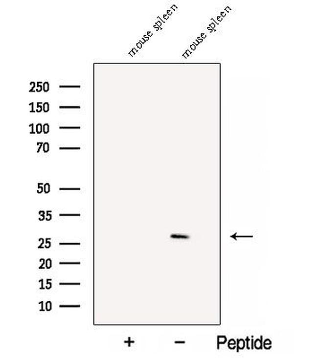 C1orf77 Antibody in Western Blot (WB)