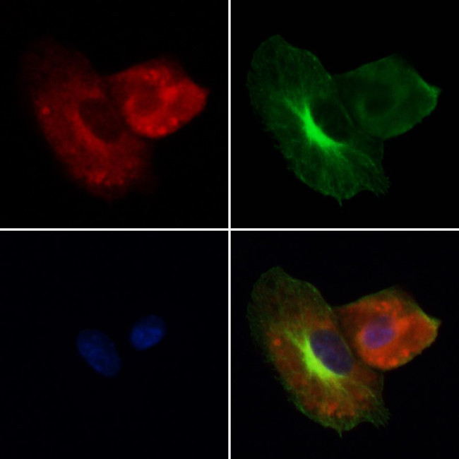 Cathepsin L Antibody in Immunocytochemistry (ICC/IF)