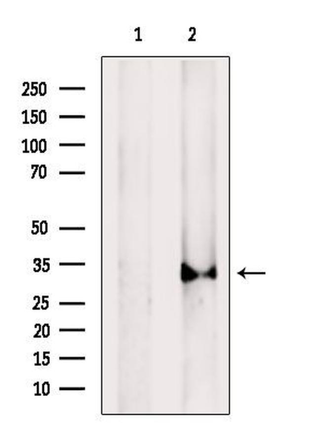 Cathepsin L Antibody in Western Blot (WB)