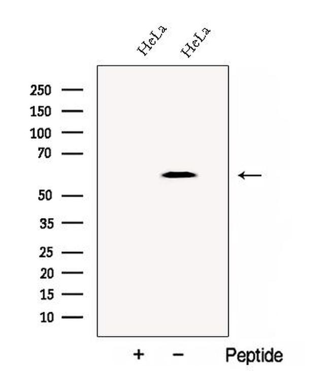 TCP-1 delta Antibody in Western Blot (WB)