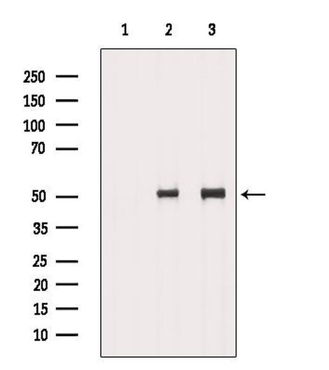 TCP-1 delta Antibody in Western Blot (WB)