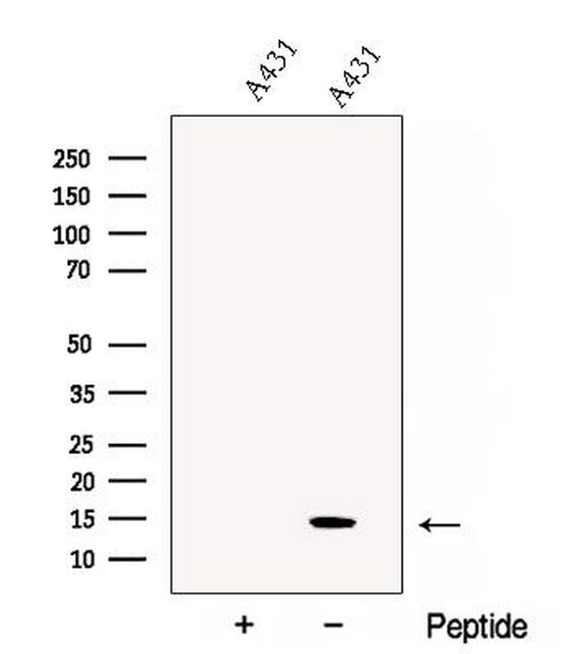 CHCHD10 Antibody in Western Blot (WB)