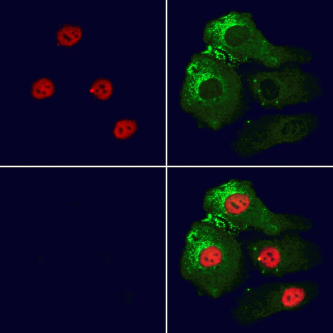 SARNP Antibody in Immunocytochemistry (ICC/IF)