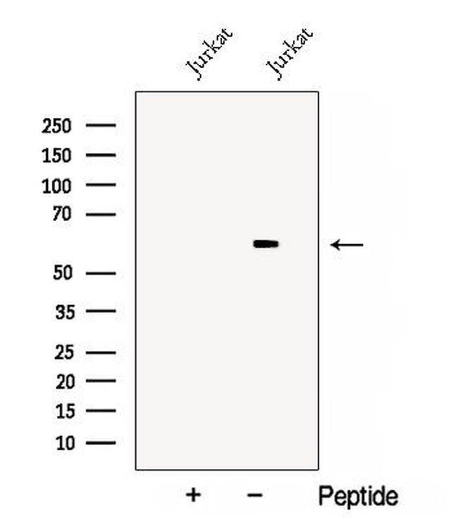 DPYSL3 Antibody in Western Blot (WB)