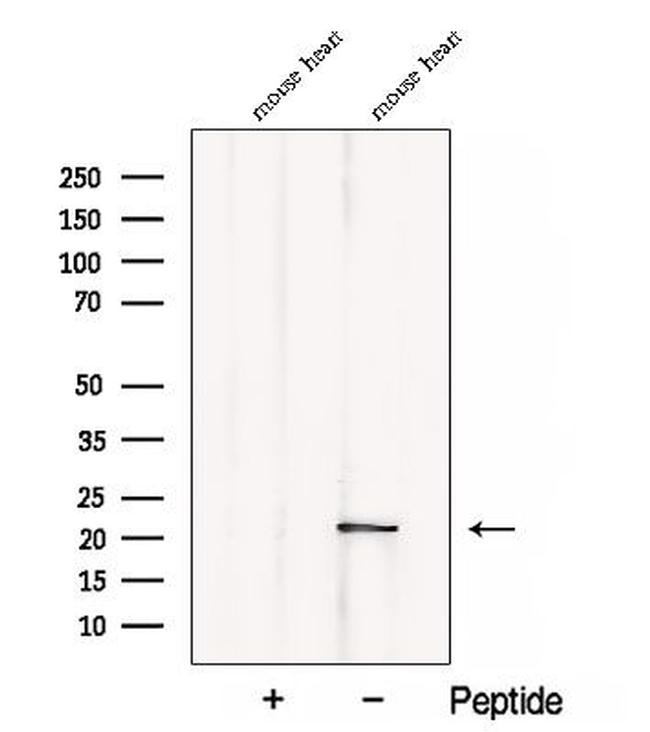 CSRP3 Antibody in Western Blot (WB)