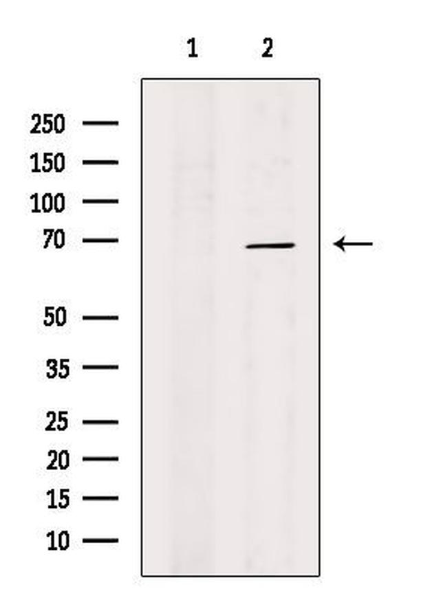 DCP1B Antibody in Western Blot (WB)