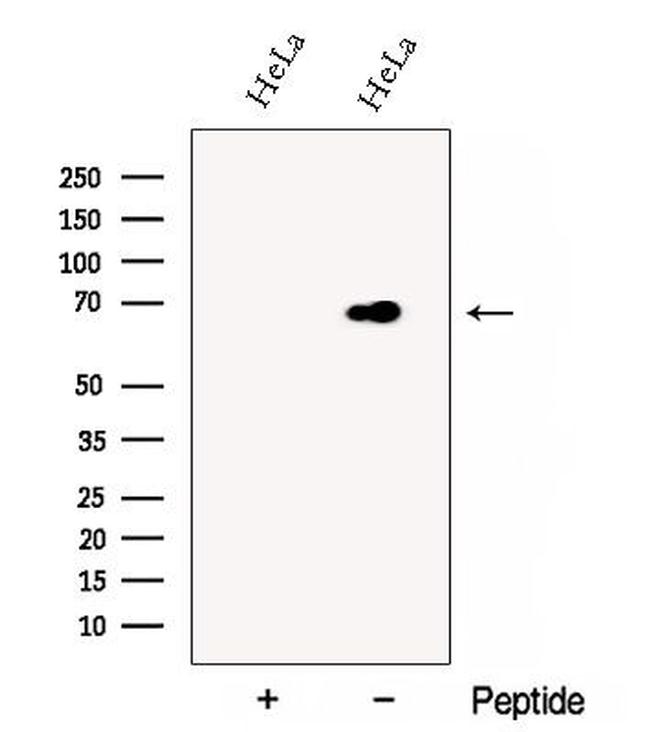 DCP1B Antibody in Western Blot (WB)