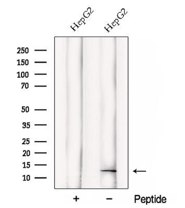 DDA1 Antibody in Western Blot (WB)