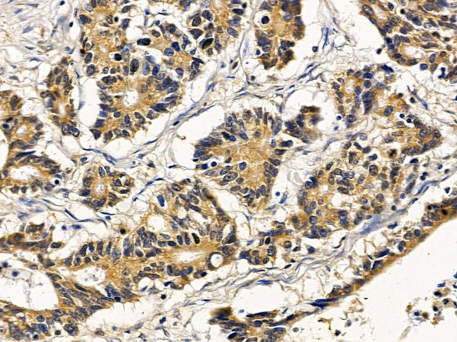 DDHD2 Antibody in Immunohistochemistry (Paraffin) (IHC (P))