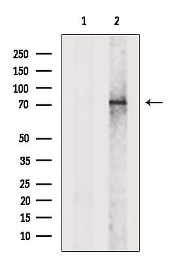DDHD2 Antibody in Western Blot (WB)