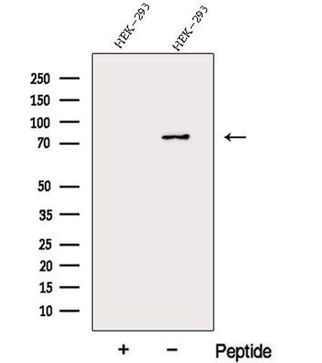 DDHD2 Antibody in Western Blot (WB)