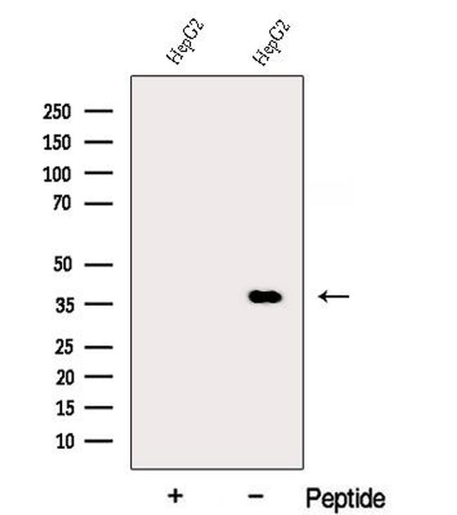 DDRGK1 Antibody in Western Blot (WB)