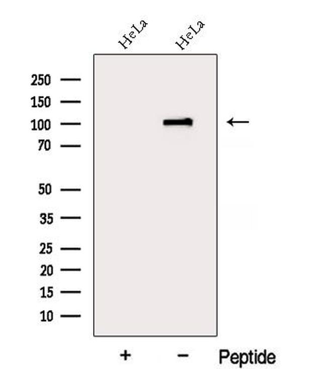 DDX10 Antibody in Western Blot (WB)