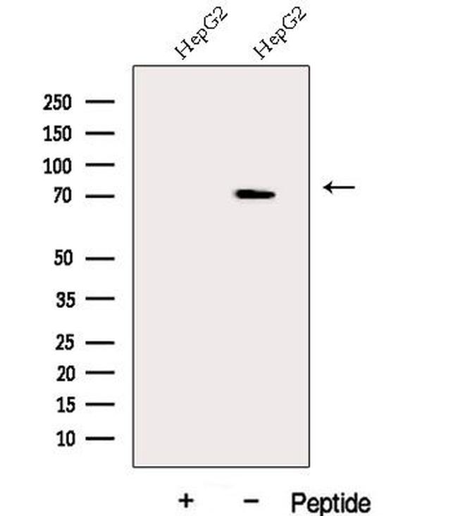 DDX43 Antibody in Western Blot (WB)