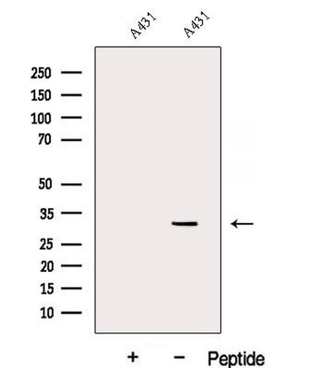 DENR Antibody in Western Blot (WB)