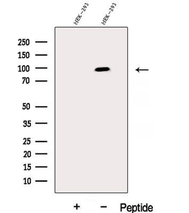 DHX15 Antibody in Western Blot (WB)