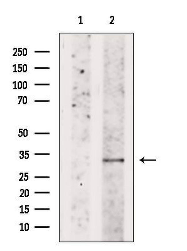DIO2 Antibody in Western Blot (WB)