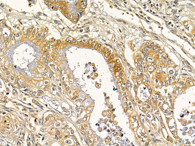 DLEU1 Antibody in Immunohistochemistry (Paraffin) (IHC (P))