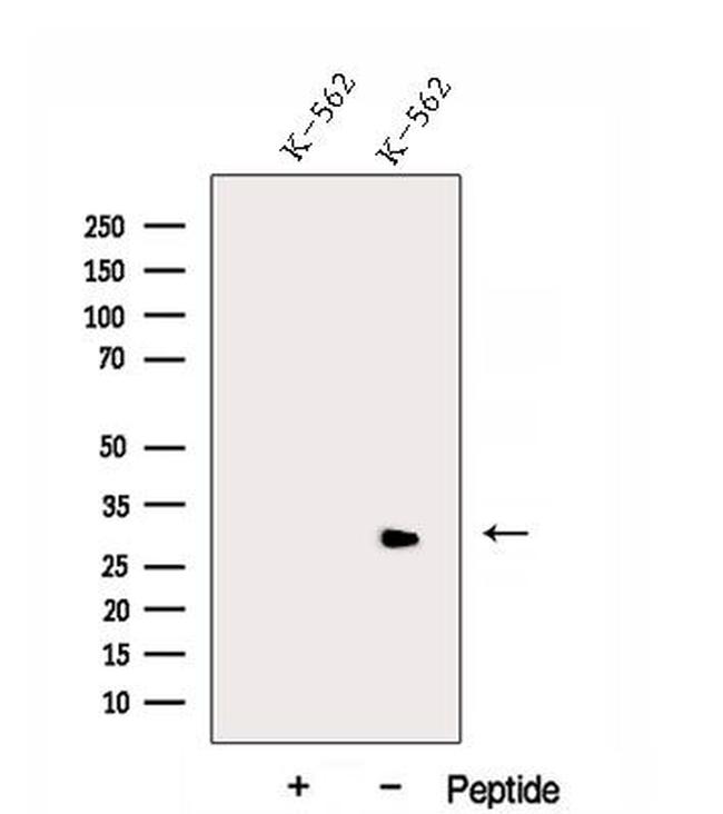 DLEU1 Antibody in Western Blot (WB)