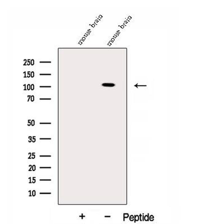 SAPAP3 Antibody in Western Blot (WB)