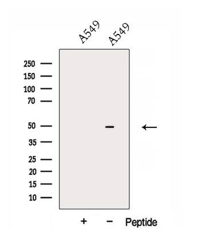 DNASE2B Antibody in Western Blot (WB)