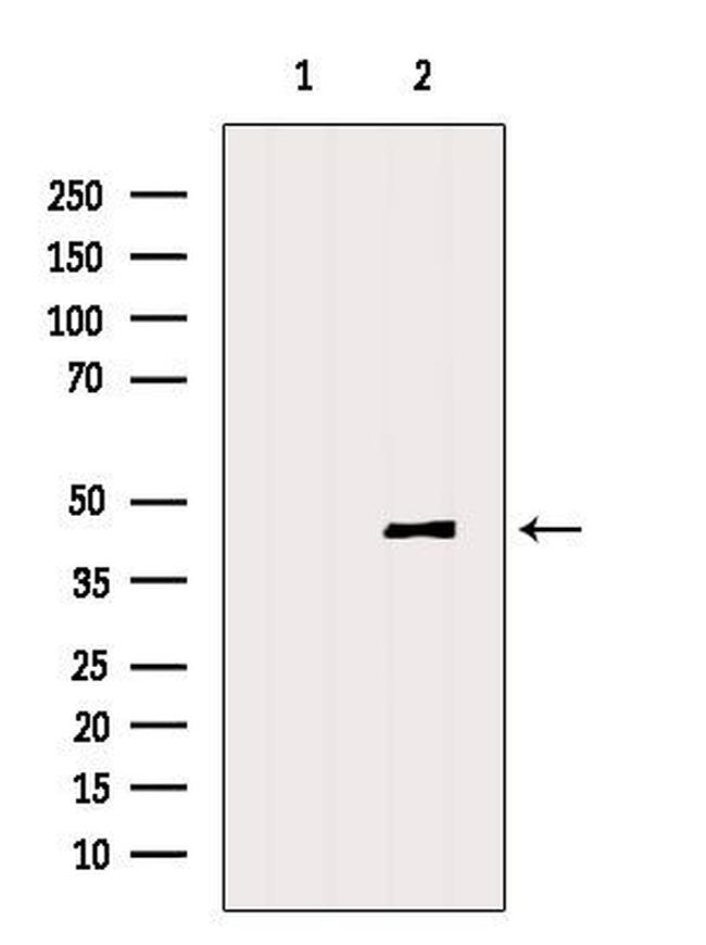 DNASE2B Antibody in Western Blot (WB)