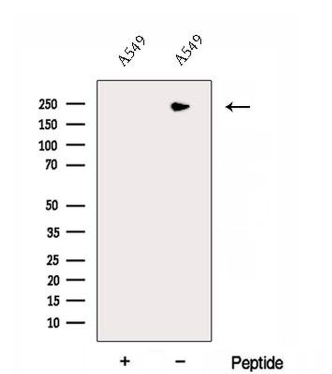 DOCK8 Antibody in Western Blot (WB)