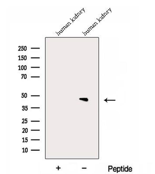 DPEP2 Antibody in Western Blot (WB)