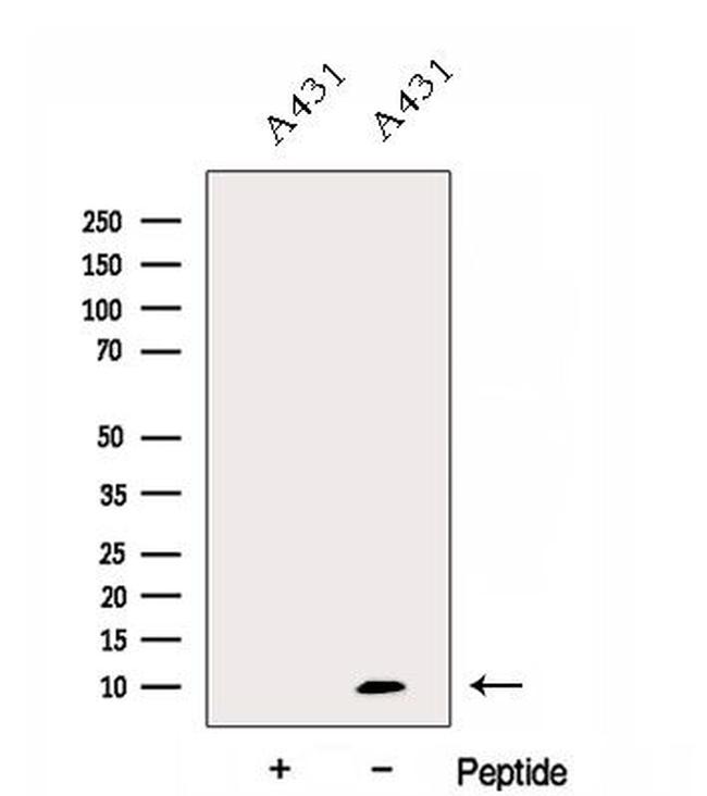 Dynein Antibody in Western Blot (WB)