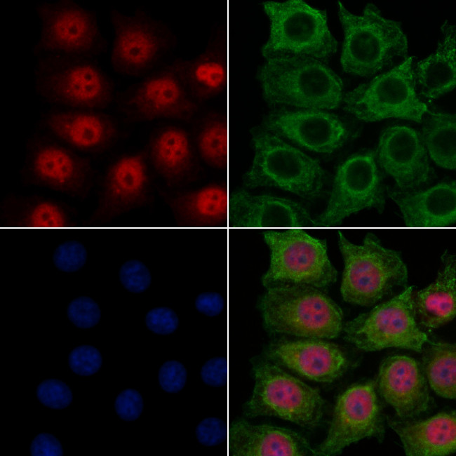 ECD Antibody in Immunocytochemistry (ICC/IF)