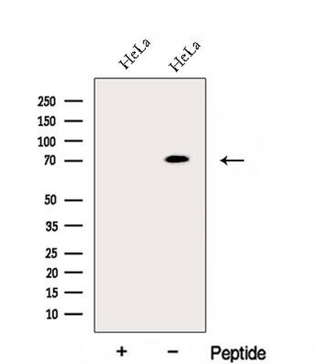 ECD Antibody in Western Blot (WB)