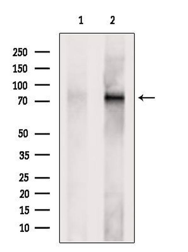 ECD Antibody in Western Blot (WB)