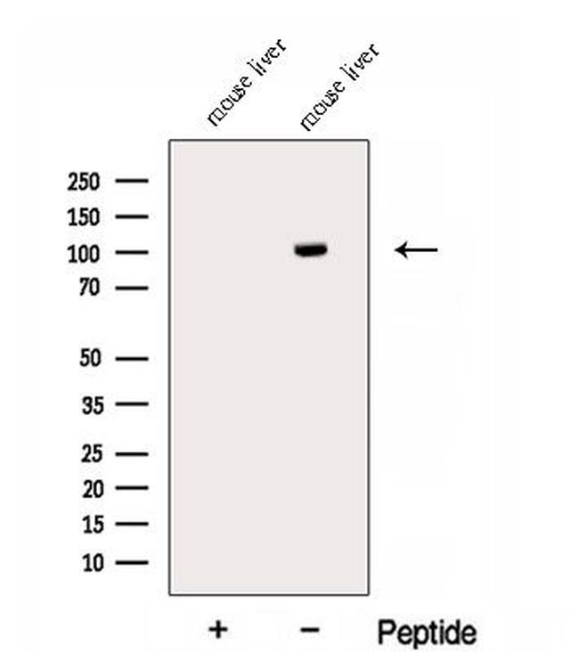 ECE2 Antibody in Western Blot (WB)