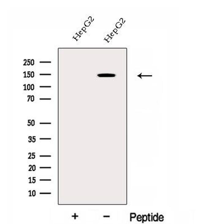 EHBP1 Antibody in Western Blot (WB)