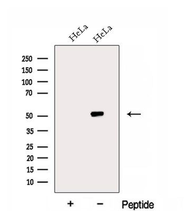 eIF2 gamma Antibody in Western Blot (WB)