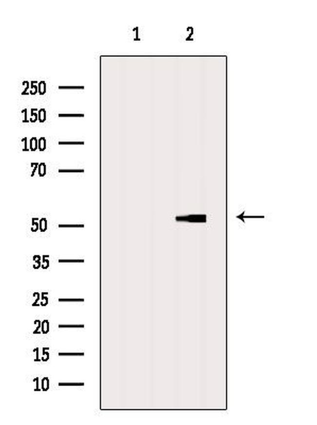 eIF2 gamma Antibody in Western Blot (WB)