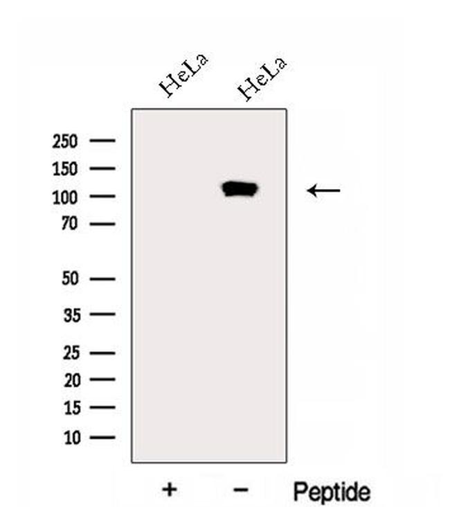 EMILIN1 Antibody in Western Blot (WB)