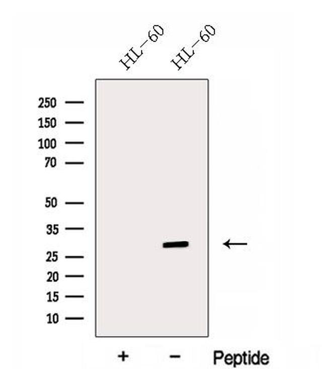 ENOPH1 Antibody in Western Blot (WB)