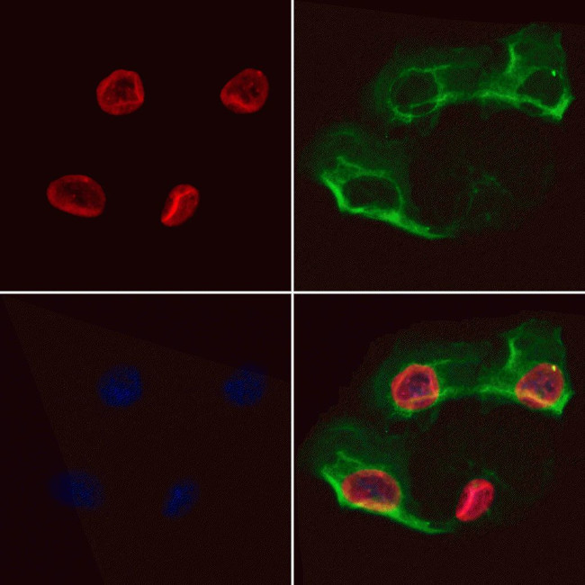 EPCR Antibody in Immunocytochemistry (ICC/IF)